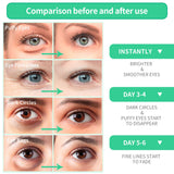 "BREYLEE Aloe Vera Eye Masks - Reduce Puffy Eyes & Dark Circles, Firm & Improve Under Eye Skin - 60 pcs